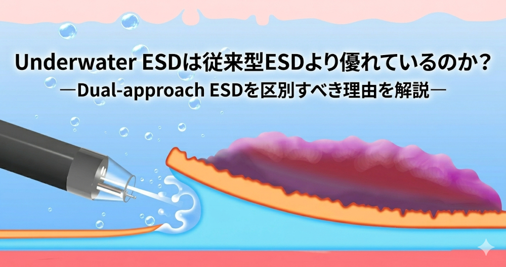 Underwater ESD（浸水下ESD）とは？原理・メリット・課題を専門医向けに整理【2026年アップデート】