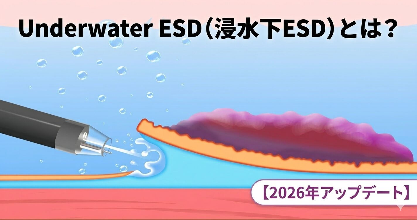 大腸ポリープの治療はどれがいい？EMRとESDの違いを専門医が解説