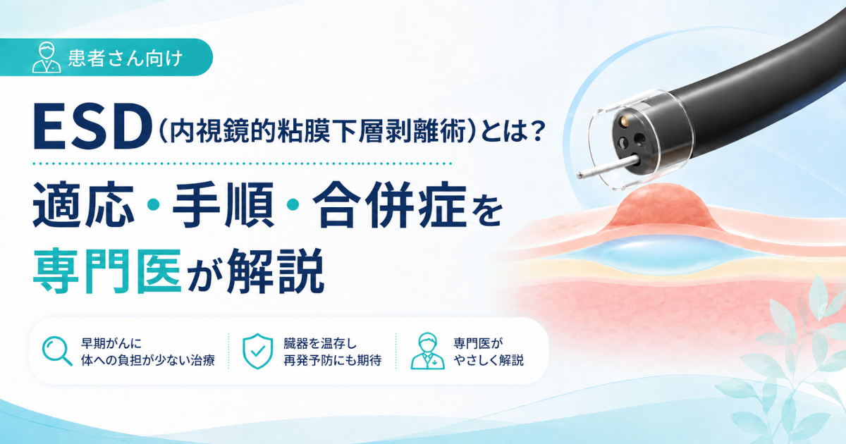 ESD（内視鏡的粘膜下層剥離術）とは？適応・手順・合併症を専門医が解説